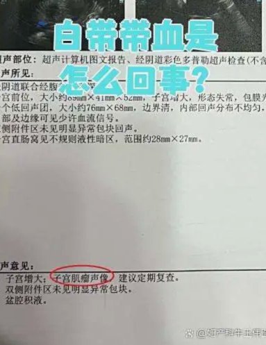 月经带血是什么原因？